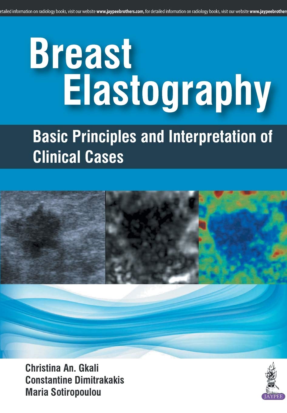 breast-elastography-basic-principles-and-interpretation-of-clinical-cases