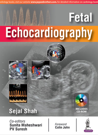 fetal-echocardiography