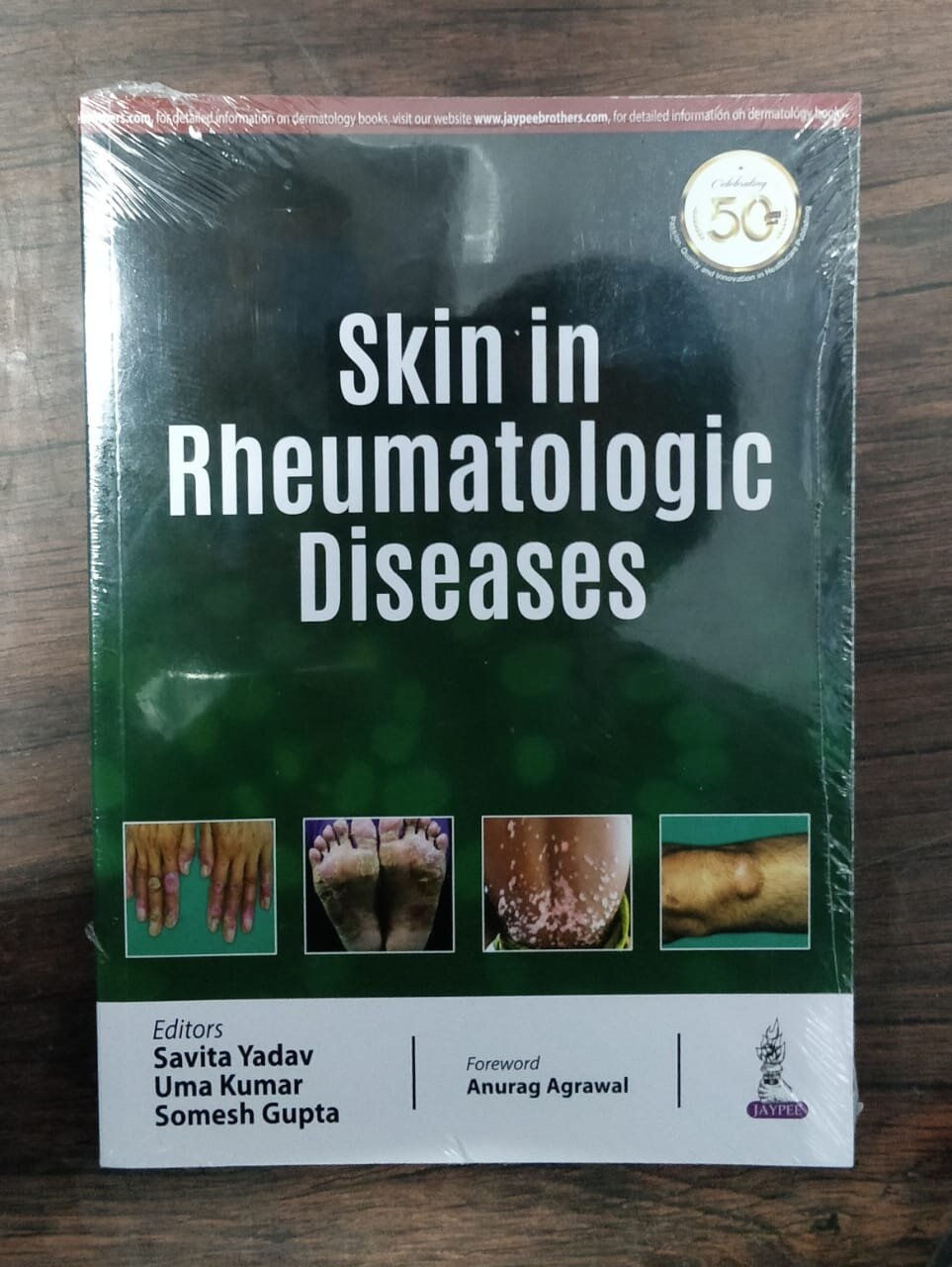 skin-rheumatologic-diseases