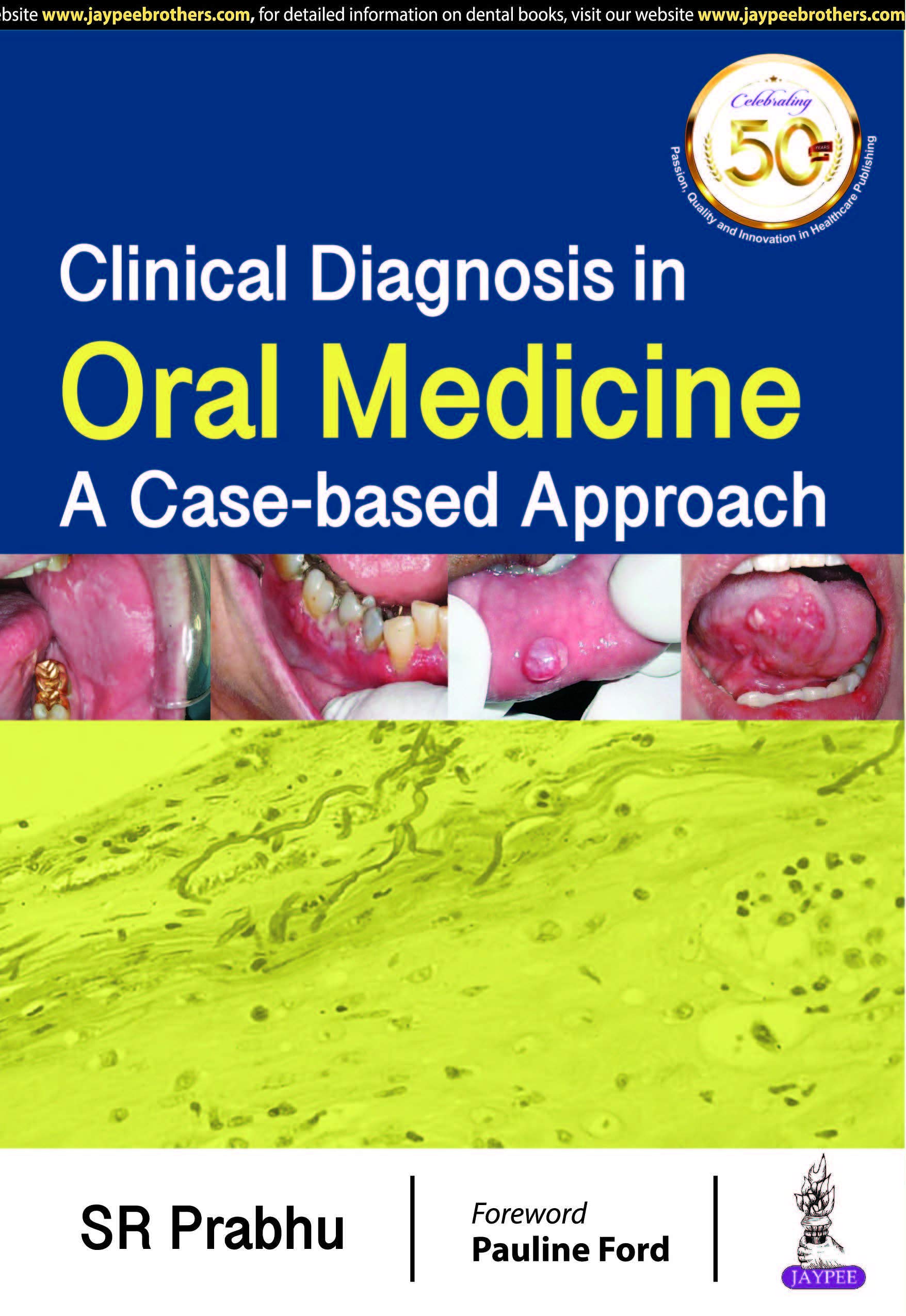 clinical-diagnosis-in-oral-medicine-a-case-based-approach