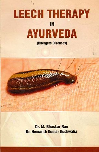 leech-threpy-in-ayurveda-bams3-