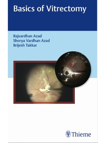 basics-of-vitrectomy-1e