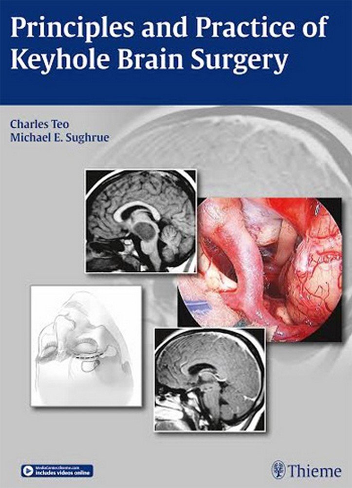 principles-and-practice-of-keyhole-brain-surgery-1e