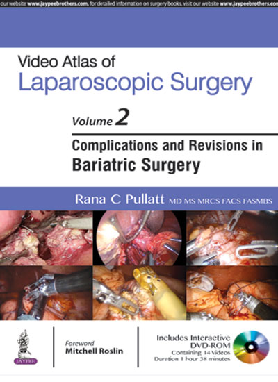 video-atlas-of-laparoscopic-surgery-vol2-complications-and-revisions-in-bariatric-surgery-with-dvd