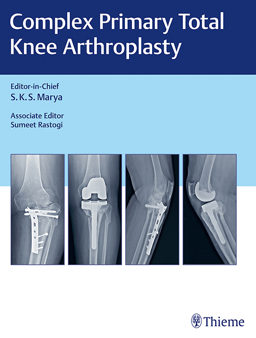 complex-primary-total-knee-arthroplasty