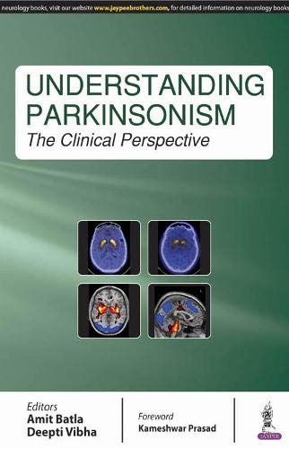 understanding-parkinsonism-the-clinical-perspective