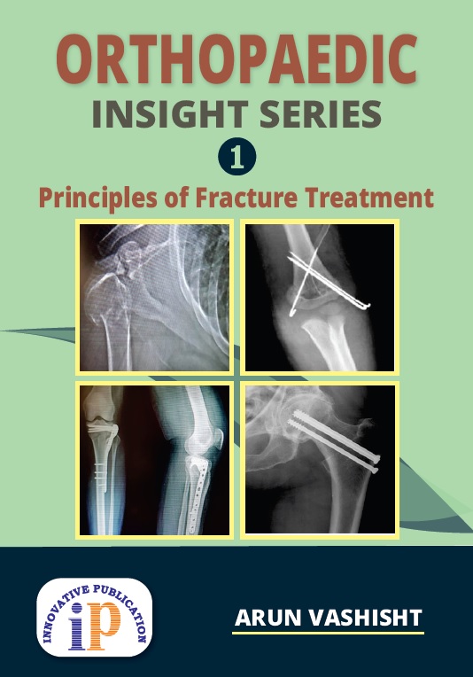orthopaedic-insight-series-1-principles-of-fracture-treatment