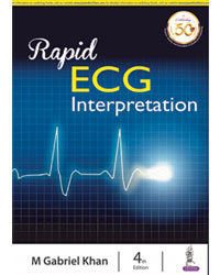 rapid-ecg-interpretation