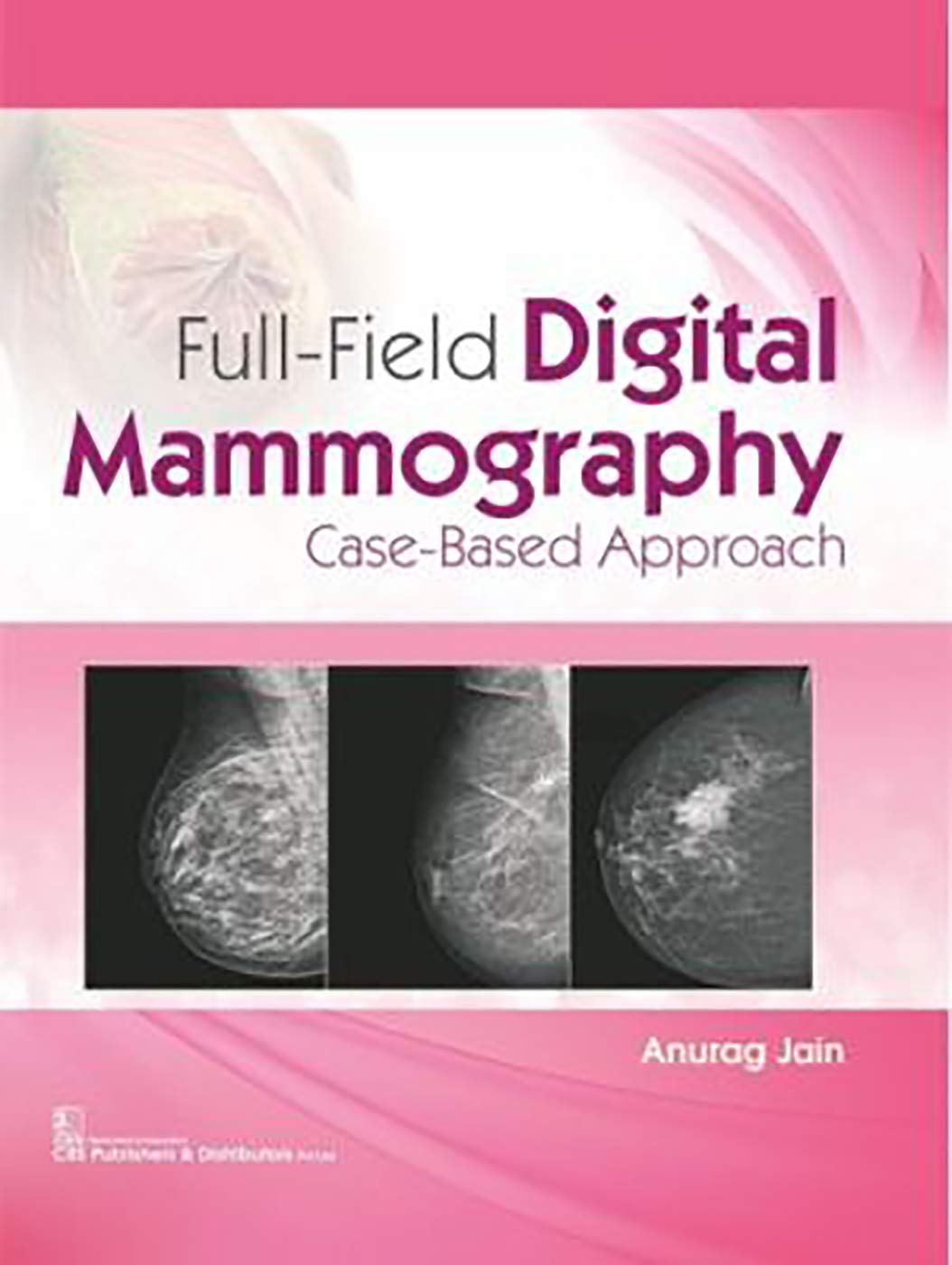 full-field-digital-mammography-case-based-approach-hb