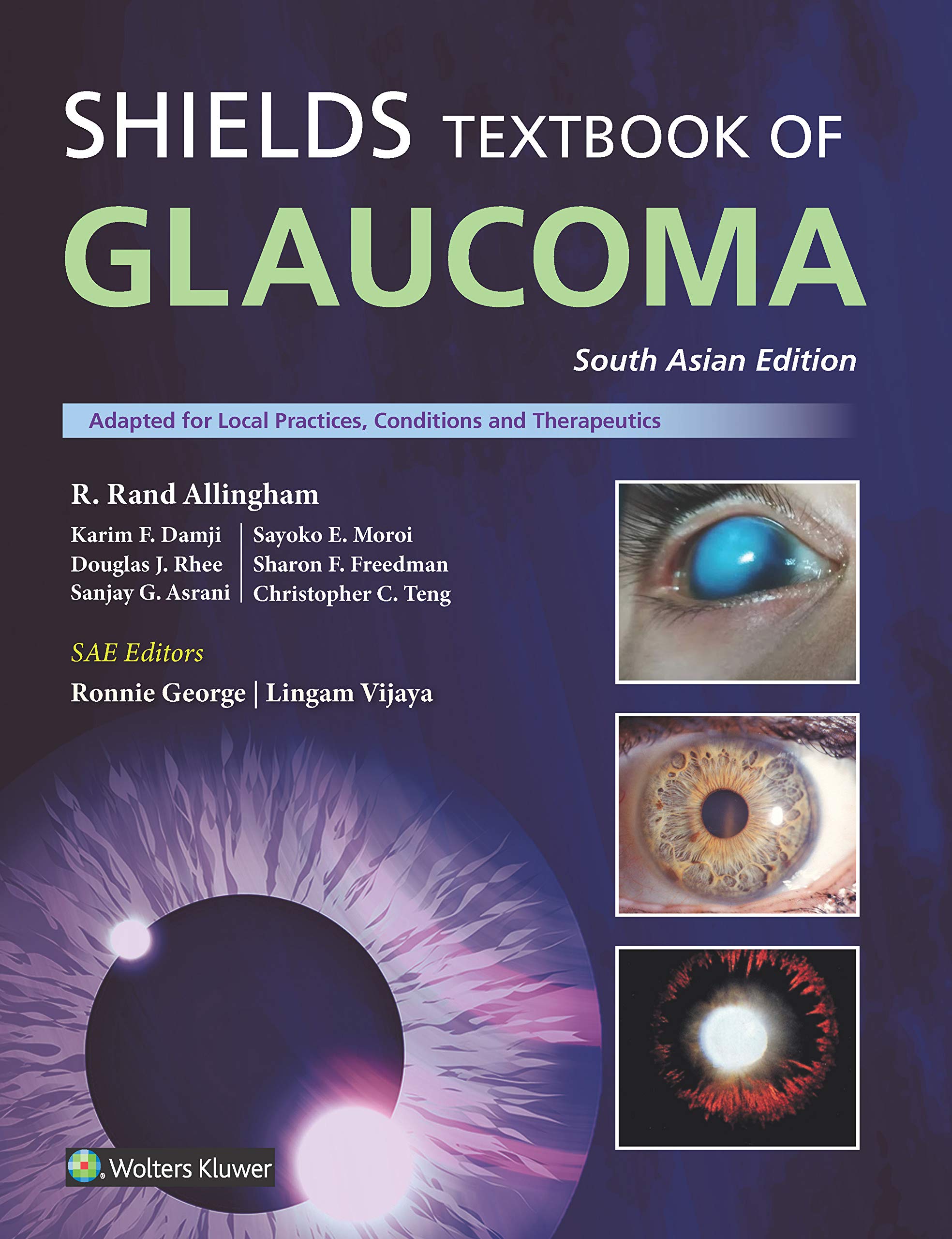 shields-textbook-of-glaucoma-south-asia-edition