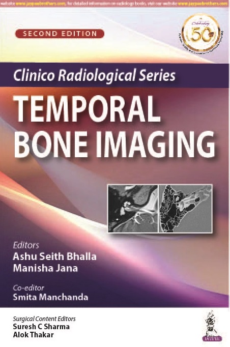 clinico-radiological-series-temporal-bone-imaging