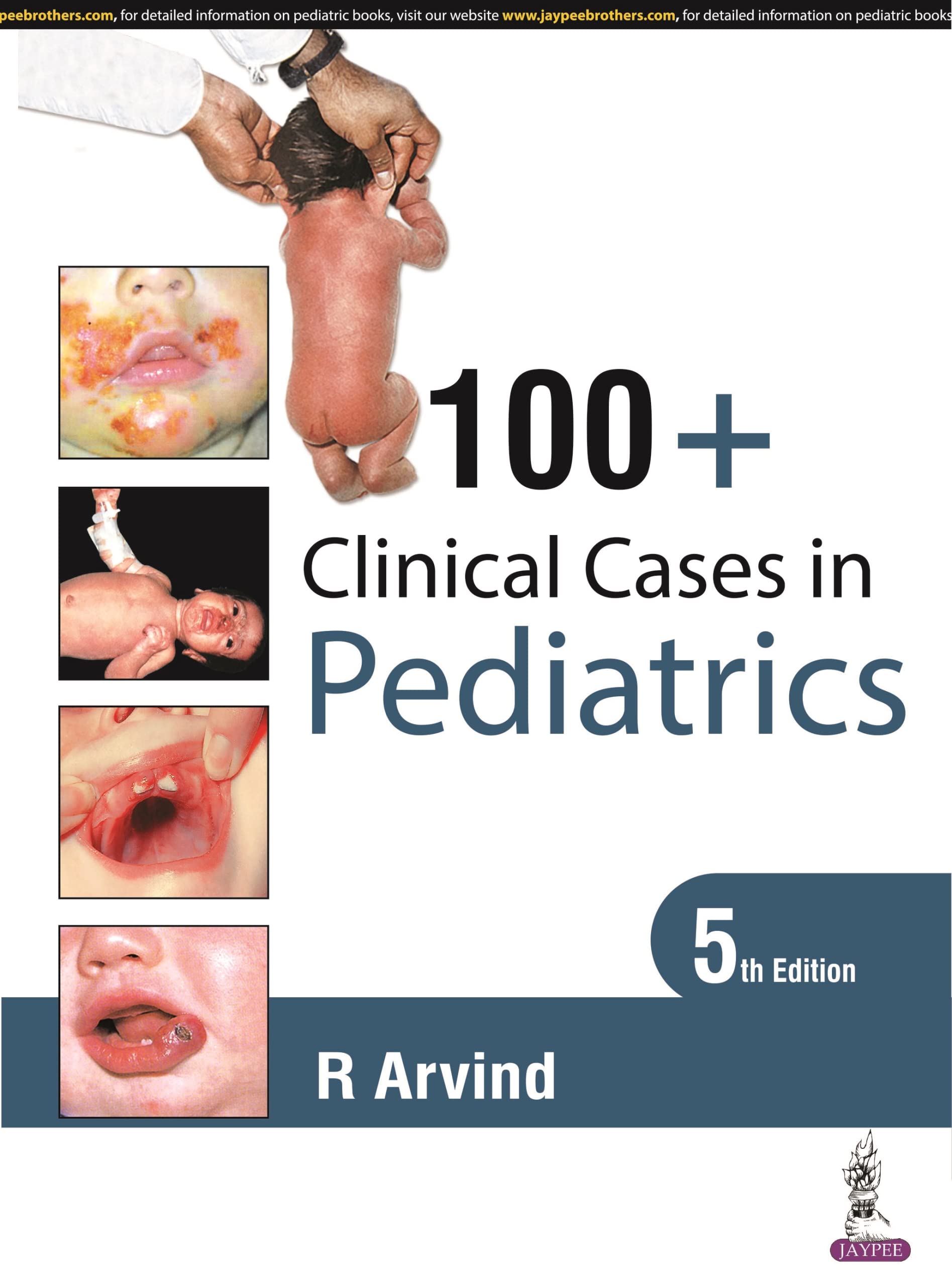 100-clincial-cases-in-pediatrics