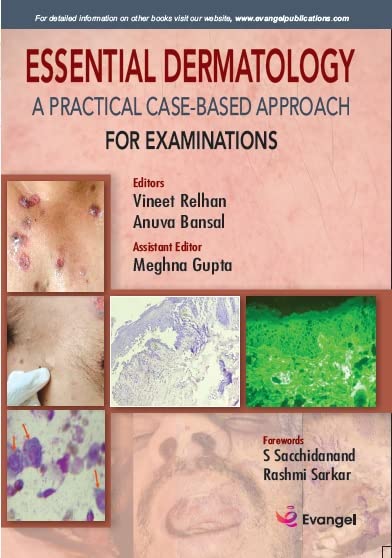 essential-dermatology-a-practical-case-based-approach-for-examinations