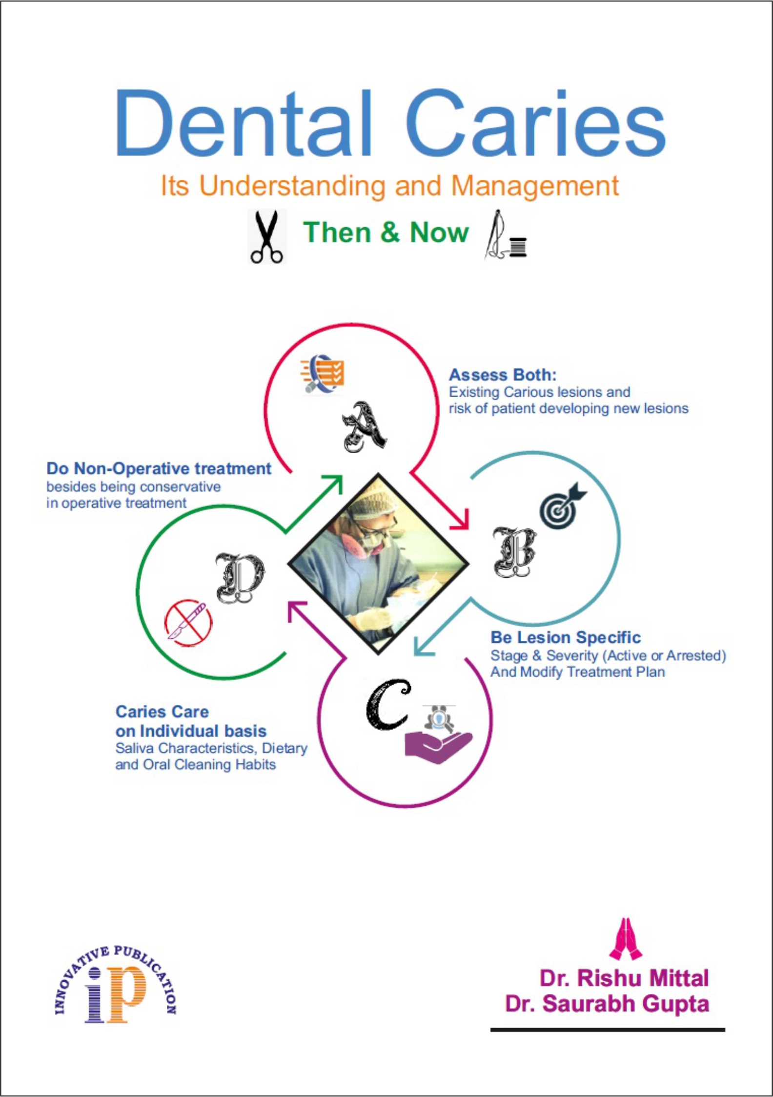 dental-caries-its-understanding-and-management-then-now